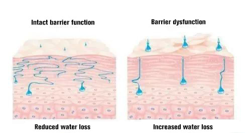 NUBWAY | How to use skincare products correctly after photoelectric surgery?