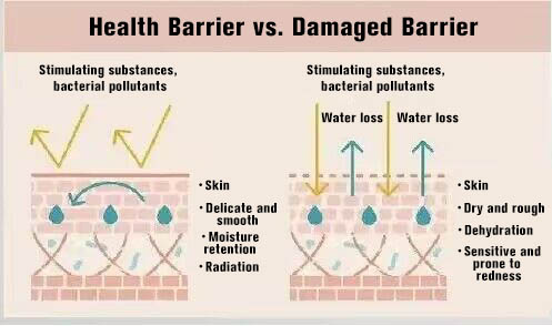 NUBWAY | Is skin barrier damaged? Repair it! Try these 4 steps!