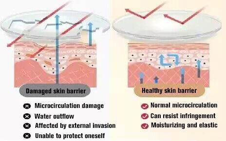 NUBWAY | Is skin barrier damaged? Repair it! Try these 4 steps!