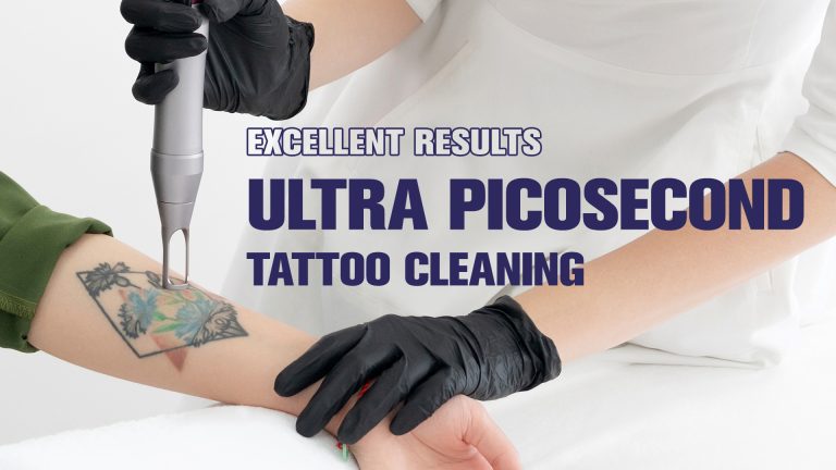 Ultra Picosecond Tattoo Cleaning