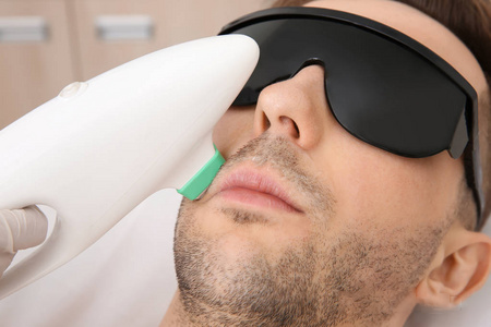 NUBWAY | Several things you must know about diode laser hair removal