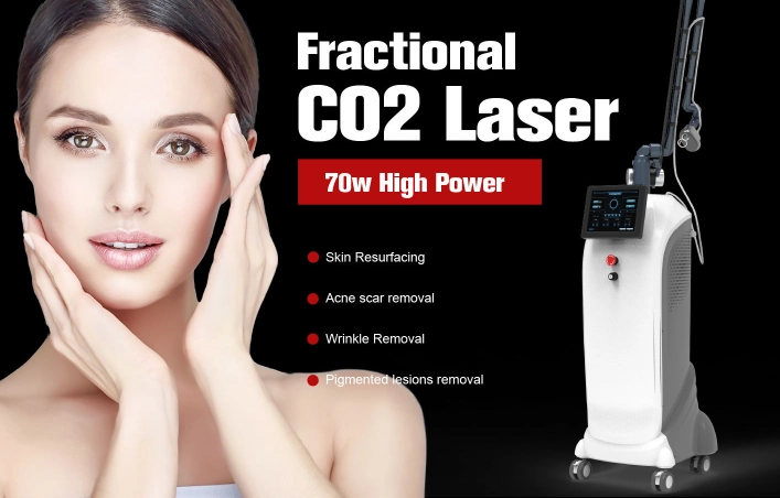 CO2 laser treatments1