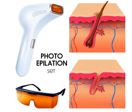 NUBWAY | Several things you must know about diode laser hair removal