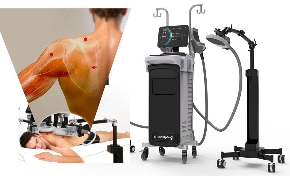 NUBWAY | Exploring Rf+Ems Sculpting: How Frequently Should You Use It?