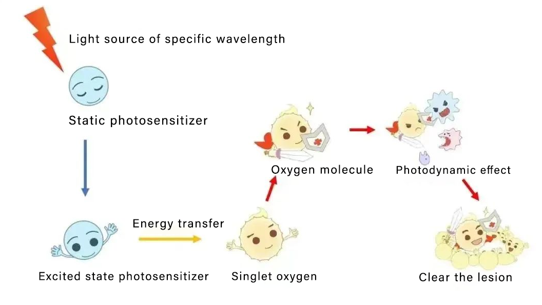 NUBWAY | Some knowledge about photodynamic therapy